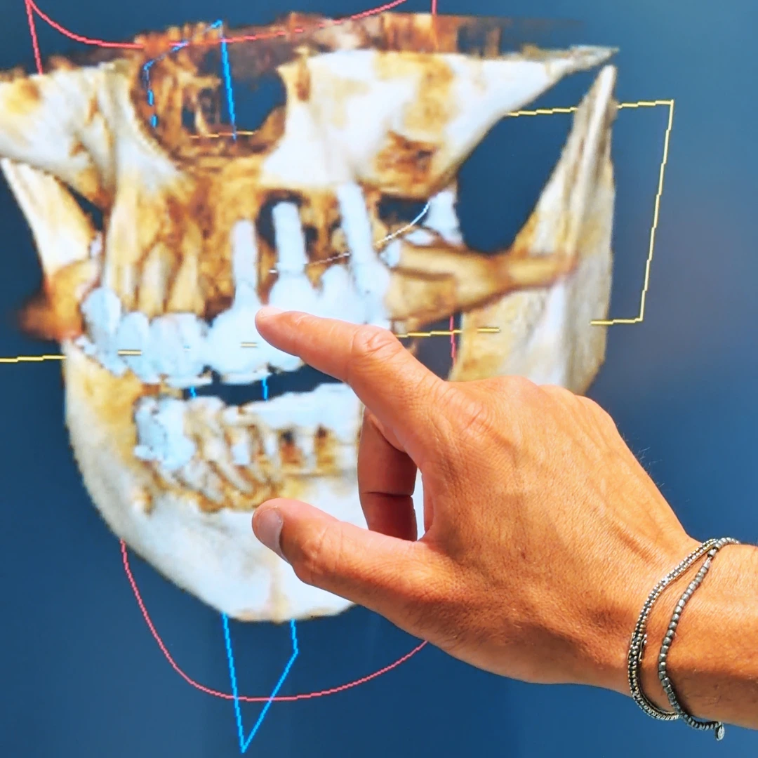 Mori - Studio dentistico Stoffella - dentista Rovereto Impianto Dentale a Rovereto