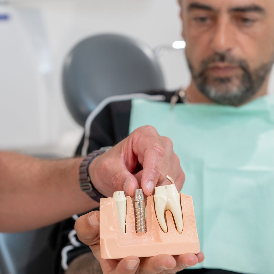 Impianto dentale a Rovereto - Stoffella - come si effettua un impianto dentale