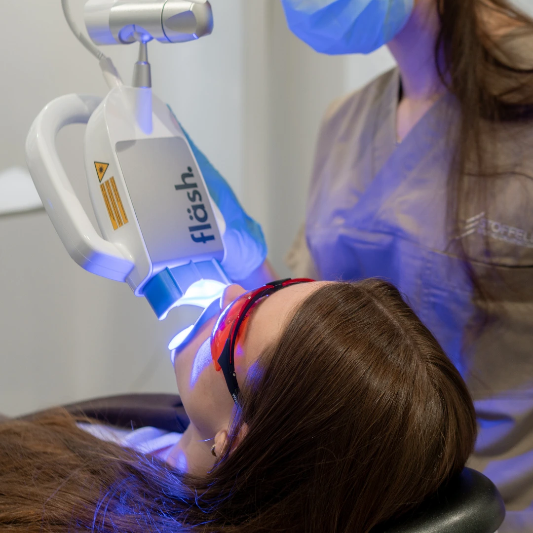 Sbiancamento dentale a Rovereto - sbiancamento dentale dal dentista