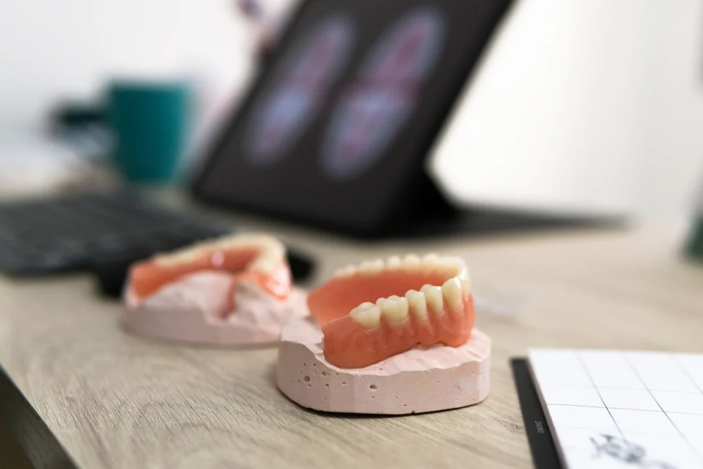 Protesi dentale mobile o impianti: cosa scegliere - Studio dentistico Stoffella - dentista Rovereto Protesi dentale mobile o impianti