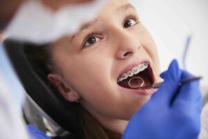 Apparecchio per bambini: una guida completa per i genitori - Studio dentistico Stoffella - dentista Rovereto Apparecchio per bambini