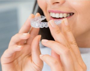 Mascherine trasparenti per i denti