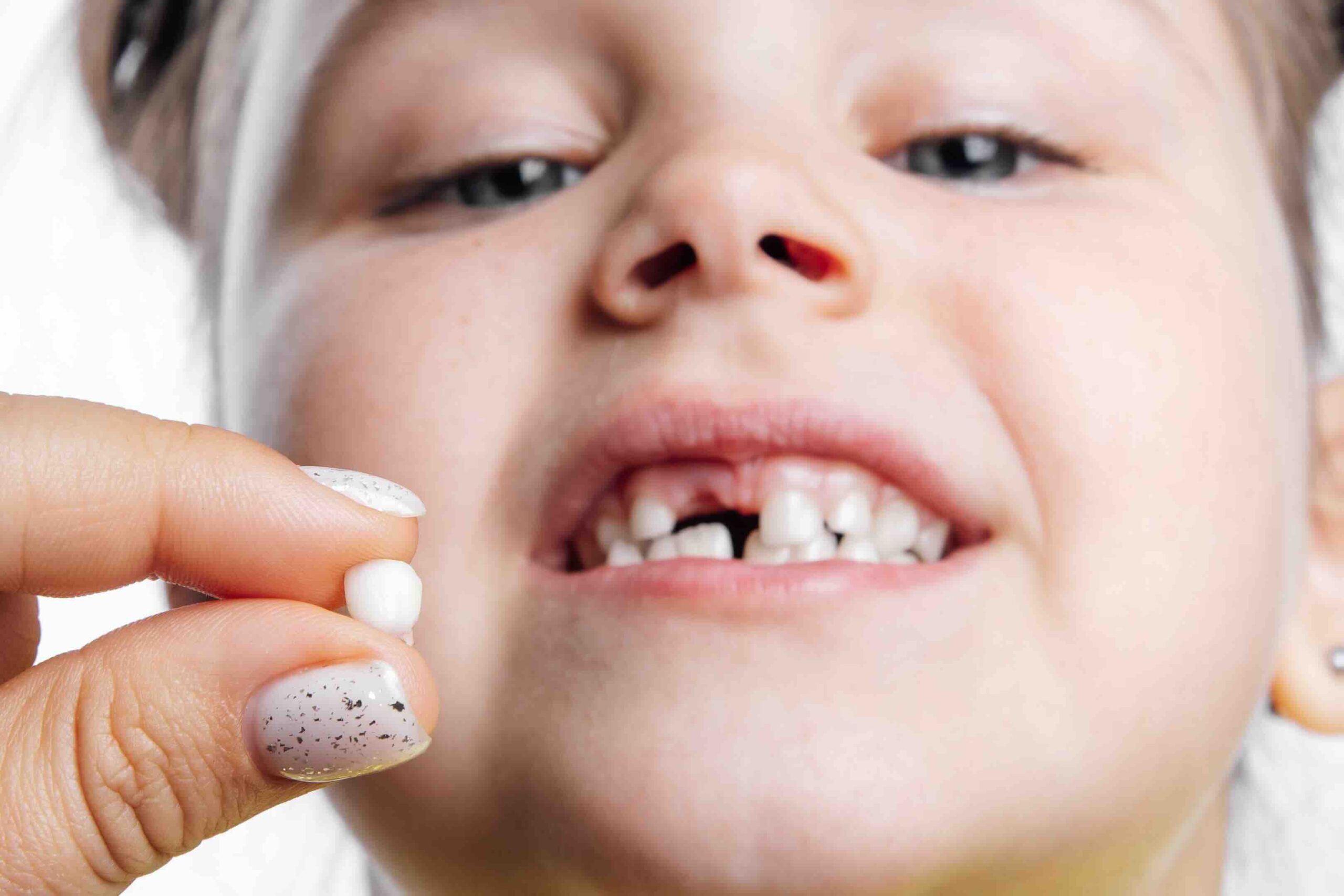 quando cadono i denti da latte