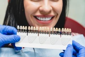 faccette dentali si rovinano