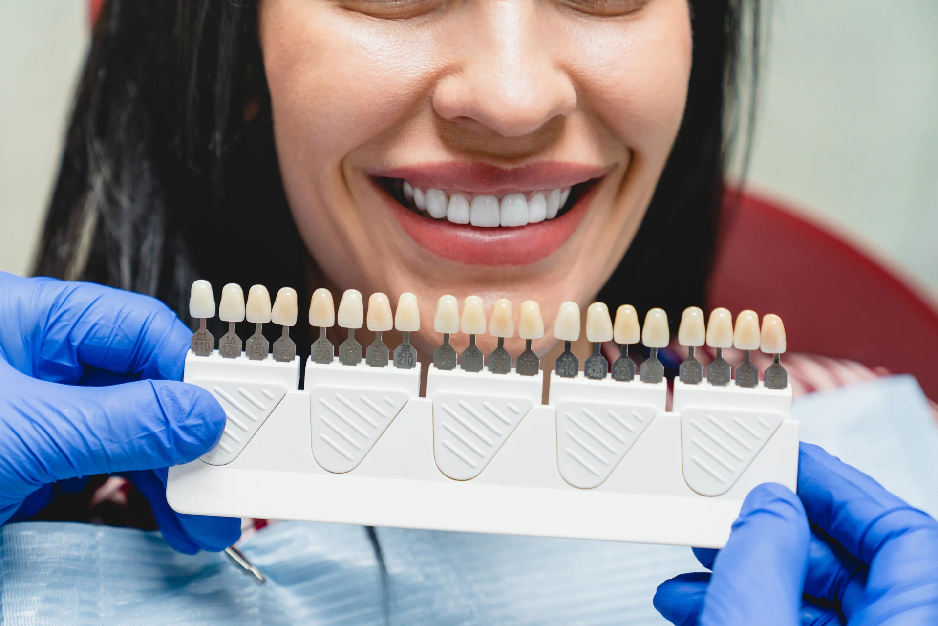 faccette dentali si rovinano